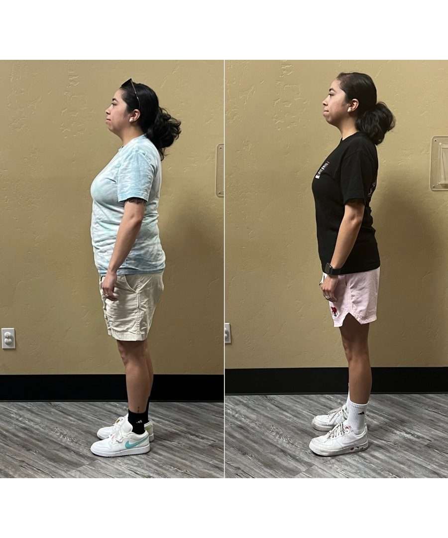 35-year-old female weight loss before and after